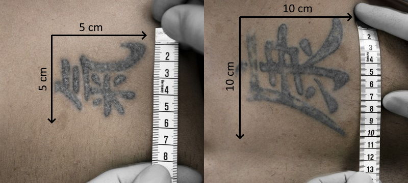 Grösse des Tattoos für die Tattooentfernung in Frauenfeld ausmessen – Länge und Breite in Zentimetern